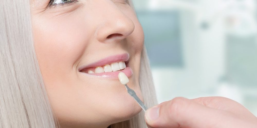 Enhancing Your Smile With Dental Veneers in San Francisco 94111 Dental Veneers in San Francisco. YBD. General, Cosmetic, Restorative, Family Dentistry Dentist in San Francisco 94111. Call:415-872-9020. Porcelain Veneers Yerba Buena Dentistry. Dr. Jiahua Zhu Dr. Semi Lim Dr. Varghah Lotfi Dr. Amrit K Sethi. General, Cosmetic, Restorative, Preventative Family Dentistry Dentist CA 94111