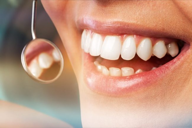 Odontology,Periodontal,Attractive,Teenager,Beautiful,Girl,Bleaching Cosmetic Dentist in San Francisco, Cosmetic Dentistry