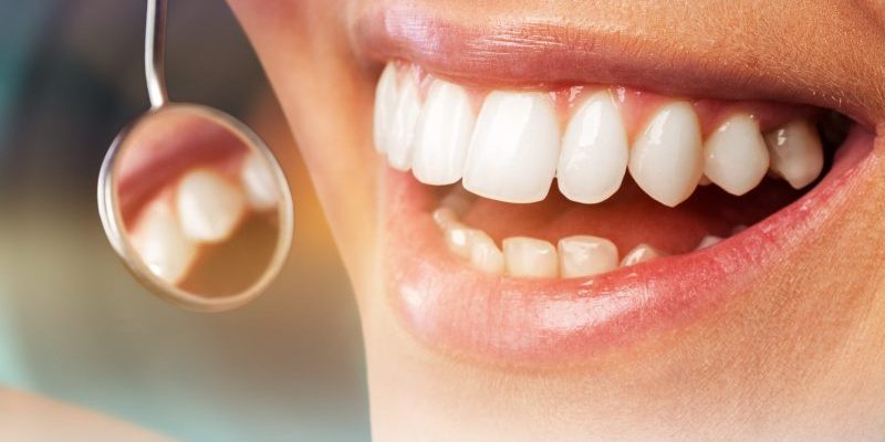 Odontology,Periodontal,Attractive,Teenager,Beautiful,Girl,Bleaching Cosmetic Dentist in San Francisco, Cosmetic Dentistry