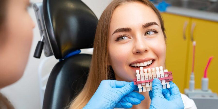 Dental Veneers San Francisco